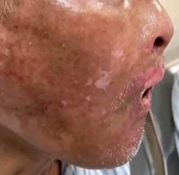 Seo-bong-truoc-pt4